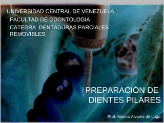 FACULTAD DE ODONTOLOGIA
CATEDRA DENTADURAS PARCIALES REMOVIBLES
PREPARACIÓN DE
DIENTES PILARES
Prof. Marina Alvarez de Lugo
UNIVERSIDAD CENTRAL DE VENEZUELA
 