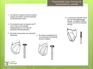 1. La reducción lingual cóncava incisal al
cíngulo se emplea una fresa pequeña
de diamante tipo rueda
2. Es necesario crear un espacio de 0.7
mm o mas con los dientes
antagonistas Con una fresa de
diamante redonda pequeña
3. Se hacen surcos para una reducción
adecuada 4. Se reduce incisalmente en
una inclinación del reborde
incisal no tallado
5) La pared axial linguales reduce
con una fresa diamante tipo
torpedo AL MISMO TIEMPO
creando una línea de acabado
chamfer
 
