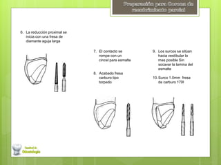 6. La reducción proximal se
inicia con una fresa de
diamante aguja larga
7. El contacto se
rompe con un
cincel para esmalte
8. Acabado fresa
carburo tipo
torpedo
9. Los surcos se sitúan
hacia vestíbular lo
mas posible Sin
socavar la lamina del
esmalte
10.Surco 1.0mm fresa
de carburo 170l
 
