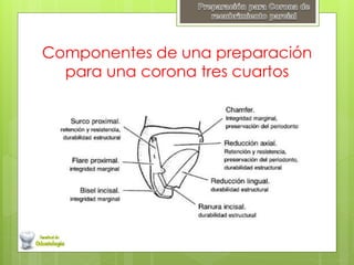Componentes de una preparación
para una corona tres cuartos
 