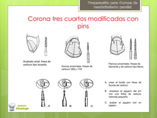 Corona tres cuartos modificadas con
pins
Acabado axial: fresa de
carburo tipo torpedo
Surcos proximales: fresas de
carburo 169l y 170l
Flancos proximales: fresas de
diamante y de carburo tipo llama
A. crear el borde con fresa de
fisuras de carburo
B. empezar el agujero del pin
con una fresa de carburo
redonda pequeña
C. acabar el agujero con un
taladro
 