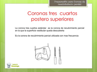 Coronas tres cuartos
postero superiores
La corona tres cuartos estándar es la corona de recubrimiento parcial
en la que la superficie vestibular queda descubierta
Es la corona de recubrimiento parcial utilizada con mas frecuencia
 