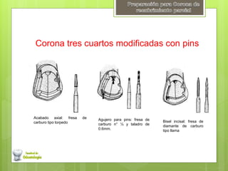 Corona tres cuartos modificadas con pins 
Acabado axial: fresa de 
carburo tipo torpedo 
Agujero para pins: fresa de 
carburo n° ½ y taladro de 
0.6mm. 
Bisel incisal: fresa de 
diamante de carburo 
tipo llama 
 