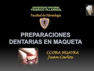 UNIVERSIDAD NACIONAL
FEDERICO VILLARREAL
Facultad de Odontología
CCORA HUAYRA
Juan Carlos
 