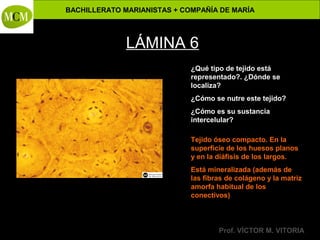 BACHILLERATO MARIANISTAS + COMPAÑÍA DE MARÍA

Anatomía y Fisiología Humanas -

LÁMINA 6
¿Qué tipo de tejido está
representado?. ¿Dónde se
localiza?
¿Cómo se nutre este tejido?
¿Cómo es su sustancia
intercelular?
Tejido óseo compacto. En la
superficie de los huesos planos
y en la diáfisis de los largos.
Está mineralizada (además de
las fibras de colágeno y la matriz
amorfa habitual de los
conectivos)

Prof. VÍCTOR M. VITORIA

 