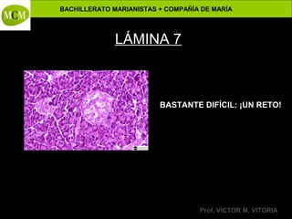 BACHILLERATO MARIANISTAS + COMPAÑÍA DE MARÍA

Anatomía y Fisiología Humanas -

LÁMINA 7

BASTANTE DIFÍCIL: ¡UN RETO!

Prof. VÍCTOR M. VITORIA

 