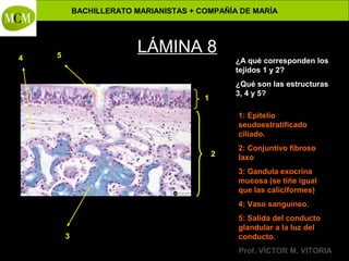 BACHILLERATO MARIANISTAS + COMPAÑÍA DE MARÍA

4

LÁMINA 8

5

¿A qué corresponden los
tejidos 1 y 2?
¿Qué son las estructuras
3, 4 y 5?

1

1: Epitelio
seudoestratificado
ciliado.
2

2: Conjuntivo fibroso
laxo
3: Gandula exocrina
mucosa (se tiñe igual
que las caliciformes)
4: Vaso sanguíneo.

3

Anatomía y Fisiología Humanas -

5: Salida del conducto
glandular a la luz del
conducto.
Prof. VÍCTOR M. VITORIA

 