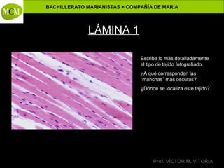 BACHILLERATO MARIANISTAS + COMPAÑÍA DE MARÍA

Anatomía y Fisiología Humanas -

LÁMINA 1
Escribe lo más detalladamente
el tipo de tejido fotografiado.
¿A qué corresponden las
“manchas” más oscuras?
¿Dónde se localiza este tejido?

Prof. VÍCTOR M. VITORIA

 