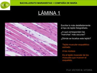 BACHILLERATO MARIANISTAS + COMPAÑÍA DE MARÍA

Anatomía y Fisiología Humanas -

LÁMINA 1
Escribe lo más detalladamente
el tipo de tejido fotografiado.
¿A qué corresponden las
“manchas” más oscuras?
¿Dónde se localiza este tejido?
Tejido muscular esquelético
estriado.
A los núcleos
Es el tejido muscular de los
músculos que mueven el
esqueleto.

Prof. VÍCTOR M. VITORIA

 