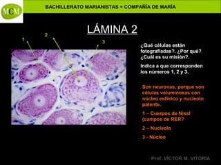 BACHILLERATO MARIANISTAS + COMPAÑÍA DE MARÍA

1

2

Anatomía y Fisiología Humanas -

LÁMINA 2
3

¿Qué células están
fotografiadas?. ¿Por qué?
¿Cuál es su misión?.
Indica a que corresponden
los números 1, 2 y 3.
Son neuronas, porque son
células voluminosas con
núcleo esférico y nucleolo
patente.
1 – Cuerpos de Nissl
(campos de RER?
2 – Nucleolo
3 - Núcleo

Prof. VÍCTOR M. VITORIA

 