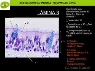 BACHILLERATO MARIANISTAS + COMPAÑÍA DE MARÍA
Identifica lo más
precisamente posible el
tejido 3. ¿Cómo se
alimenta?

LÁMINA 3
1

¿Qué es el nº 2?
2

Anatomía y Fisiología Humanas -

¿Qué tejido es el 4?. ¿Qué
lo separa del 3?
¿Qué tipo de célula es la
1?. ¿Qué fabrica y cómo lo
hace?
3

3: Epitelio
seudoestratificado
ciliado. 2: Cilios
4: Epitelio
seudoestratificado. La
lámina basal

4

1: Célula caliciforme.
Fabrica
mucopolisacáridos
Prof. VÍCTOR M. VITORIA

 