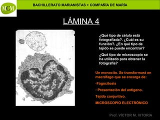 BACHILLERATO MARIANISTAS + COMPAÑÍA DE MARÍA

Anatomía y Fisiología Humanas -

LÁMINA 4
¿Qué tipo de célula está
fotografiada?. ¿Cuál es su
función?. ¿En qué tipo de
tejido se puede encontrar?
¿Qué tipo de microscopio se
ha utilizado para obtener la
fotografía?
Un monocito. Se transformará en
macrófago que se encarga de:
-Fagocitosis
- Presentación del antígeno.
Tejido conjuntivo.
MICROSCOPIO ELECTRÓNICO
Prof. VÍCTOR M. VITORIA

 
