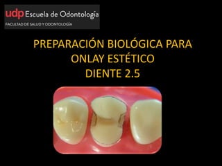 PREPARACIÓN BIOLÓGICA PARA
ONLAY ESTÉTICO
DIENTE 2.5
 