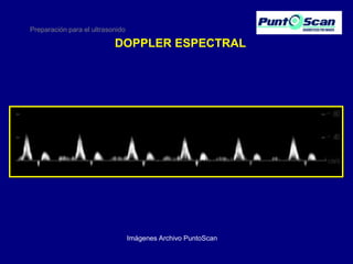 Preparación para el ultrasonido

DOPPLER ESPECTRAL

Imágenes Archivo PuntoScan

 