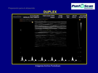 Preparación para el ultrasonido

DUPLEX

Imágenes Archivo PuntoScan

 