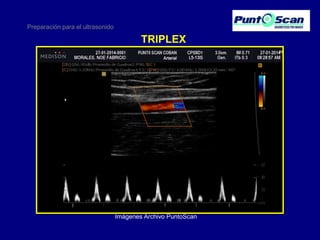 Preparación para el ultrasonido

TRIPLEX

Imágenes Archivo PuntoScan

 