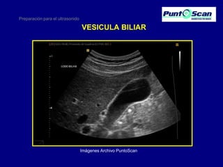Preparación para el ultrasonido

VESICULA BILIAR

Imágenes Archivo PuntoScan

 