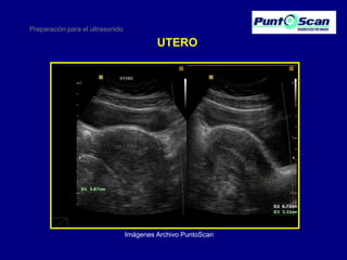 Preparación para el ultrasonido

UTERO

Imágenes Archivo PuntoScan

 