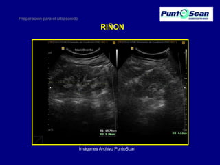 Preparación para el ultrasonido

RIÑON

Imágenes Archivo PuntoScan

 