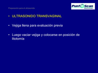 Preparación para el ultrasonido

• ULTRASONIDO TRANSVAGINAL
• Vejiga llena para evaluación previa

• Luego vaciar vejiga y colocarse en posición de
litotomía

 