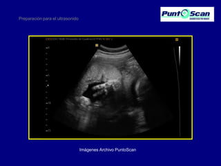 Preparación para el ultrasonido

Imágenes Archivo PuntoScan

 