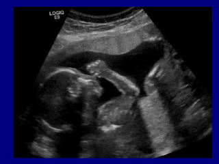 Preparación para el ultrasonido

 