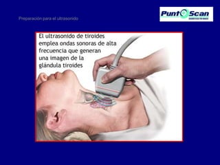 Preparación para el ultrasonido

 