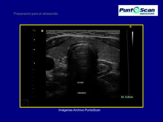 Preparación para el ultrasonido

Imágenes Archivo PuntoScan

 