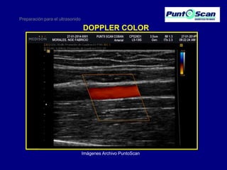 Preparación para el ultrasonido

DOPPLER COLOR

Imágenes Archivo PuntoScan

 