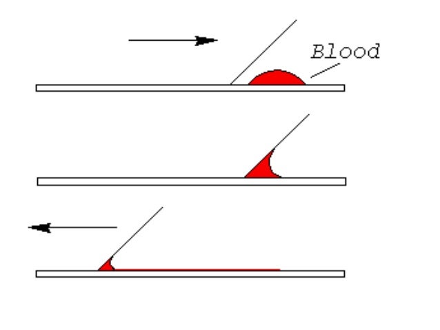 Preparation and staining of peripheral blood smear