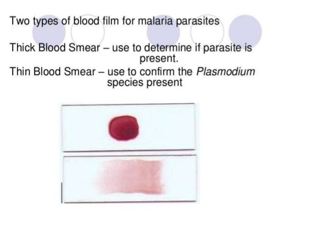 Preparation and staining of peripheral blood smear