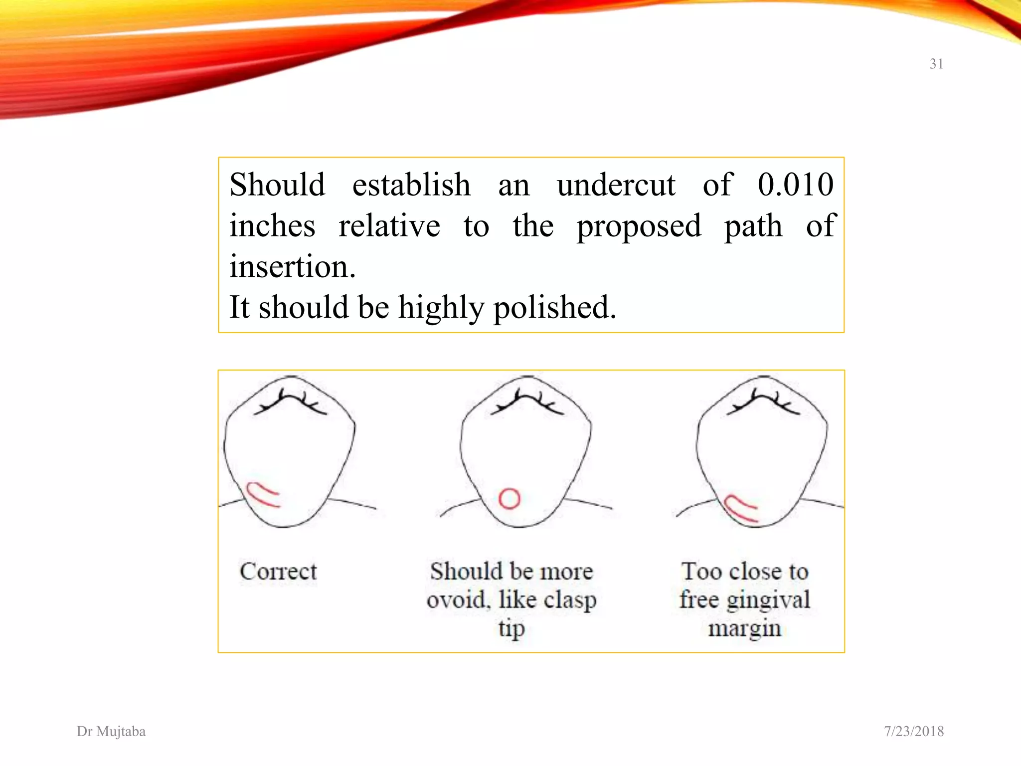 Preparation of abutment teeth | PPTX