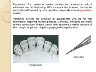Pin Ledge Preparation of partial veneer crown | PPTX