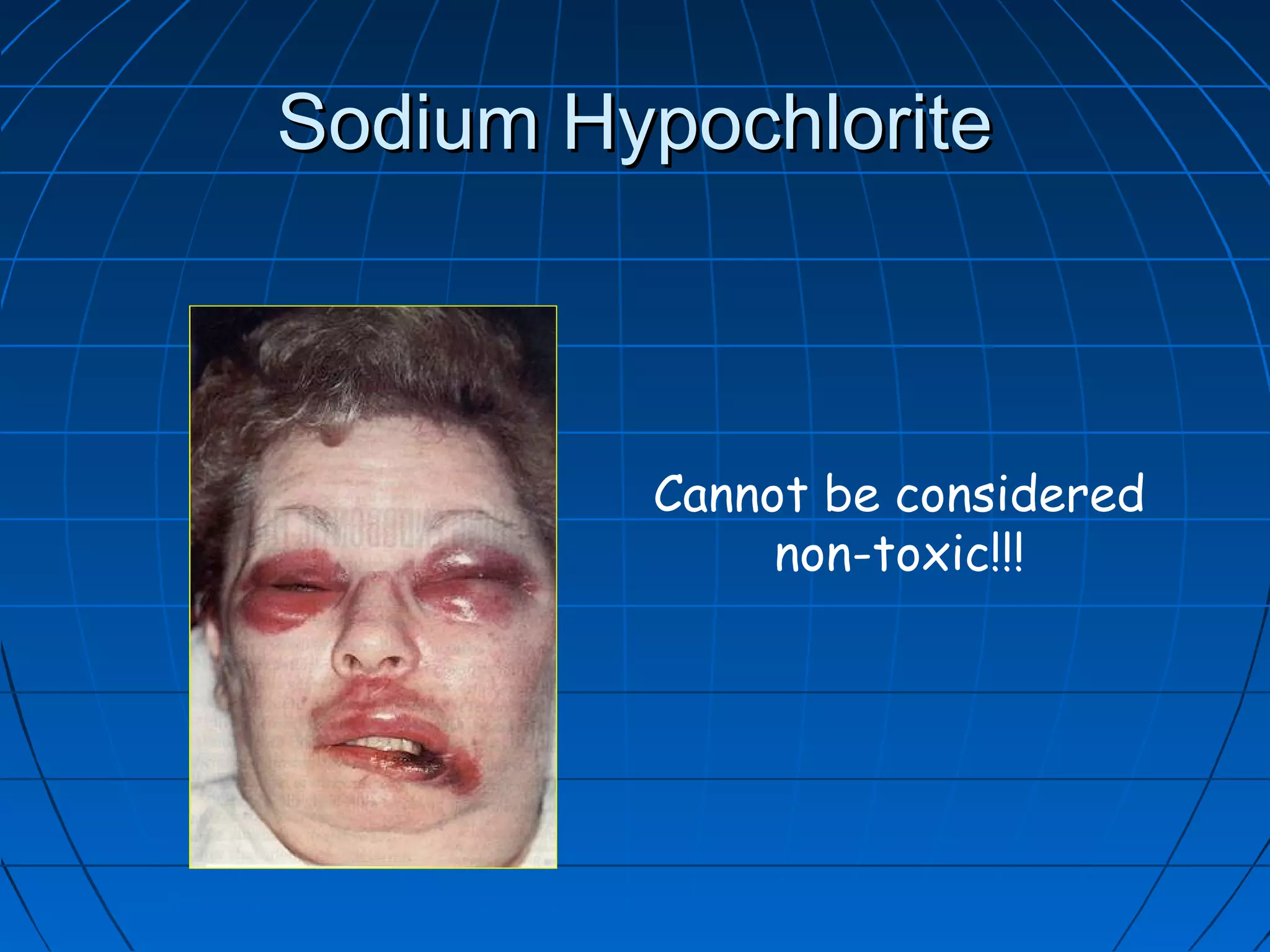 Sodium HypochloriteSodium Hypochlorite
Cannot be considered
non-toxic!!!
 