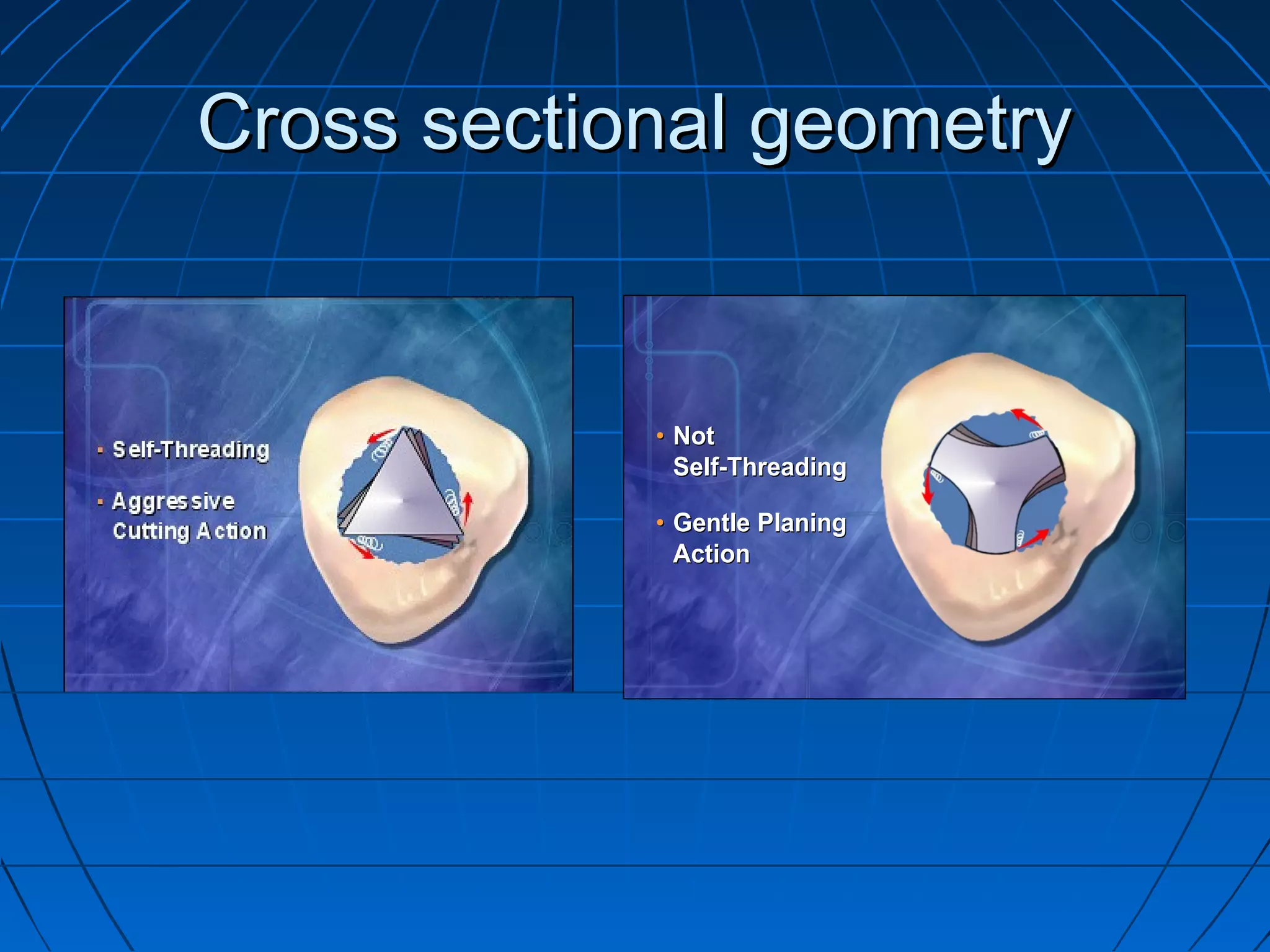 Cross sectional geometryCross sectional geometry
•• NotNot
SelfSelf--ThreadingThreading
•• Gentle PlaningGentle Planing
ActionAction
 