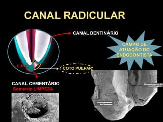 CANAL RADICULAR
C.D.C
CANAL DENTINÁRIO
CANAL CEMENTÁRIO
Somente LIMPEZA
CAMPO DE
ATUAÇÃO DO
ENDODONTISTA
COTO PULPAR
 