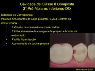 Melo-Silva 2007
Cavidade de Classe II Composta
2° Pré-Molares inferiores-DO
Extensão de Conveniência
Paredes circundantes da caixa proximal- 0,25 a 0,50mm do
dente vizinho
• Extensão de conveniência conservadora
• Fácil acabamento das margens de preparo e bordas da
restauração
• Facilita higienização
• Acomodação da papila gengival
 