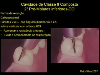Melo-Silva 2007
Cavidade de Classe II Composta
2° Pré-Molares inferiores-DO
Forma de retenção
Caixa proximal
Paredes V e L- nos ângulos diedros VA e LA
sulcos verticais com a broca 669
• Aumentar a resistência a fratura
• Evitar o deslocamento da restauração
 
