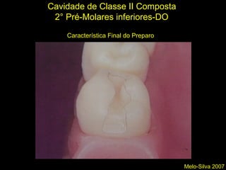Melo-Silva 2007
Cavidade de Classe II Composta
2° Pré-Molares inferiores-DO
Característica Final do Preparo
 
