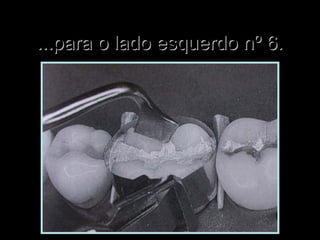 ...para o lado esquerdo nº 6....para o lado esquerdo nº 6.
 