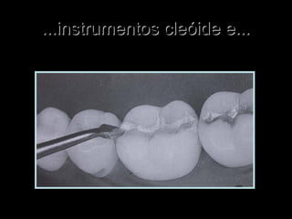 ...instrumentos cleóide e......instrumentos cleóide e...
 