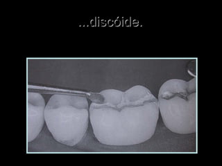 ...discóide....discóide.
 