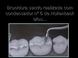 Brunidura sendo realizada comBrunidura sendo realizada com
condensador nº 6 de Hollenbackcondensador nº 6 de Hollenback
e/ou...e/ou...
 