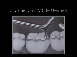 ...brunidor nº 33 de Bennett....brunidor nº 33 de Bennett.
 