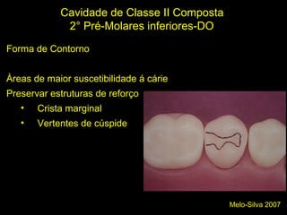 Melo-Silva 2007
Cavidade de Classe II Composta
2° Pré-Molares inferiores-DO
Forma de Contorno
Àreas de maior suscetibilidade á cárie
Preservar estruturas de reforço
• Crista marginal
• Vertentes de cúspide
 