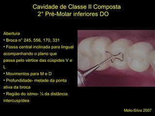Melo-Silva 2007
Cavidade de Classe II Composta
2° Pré-Molar inferiores DO
Abertura
• Broca n° 245, 556, 170, 331
• Fossa central inclinada para lingual
acompanhando o plano que
passa pelo vértice das cúspides V e
L
• Movimentos para M e D
• Profundidade- metade da ponta
ativa da broca
• Região do istmo- ¼ da distância
intercuspídea
 