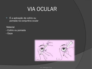 Enf. Wellington Cruz
VIA OCULAR
 É a aplicação de colírio ou
pomada na conjuntiva ocular
Material
- Colírio ou pomada
- Gaze
 