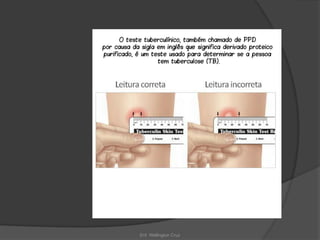 Enf. Wellington Cruz
 