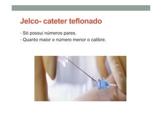 Jelco- cateter teflonado
• Só possui números pares.
• Quanto maior o número menor o calibre.
 