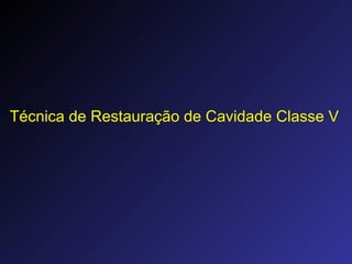 Técnica de Restauração de Cavidade Classe V
 
